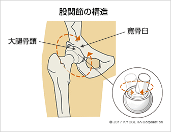 股関節の構造