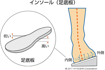インソール（足底板）