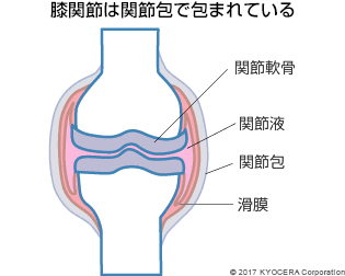 膝関節は関節包で包まれている