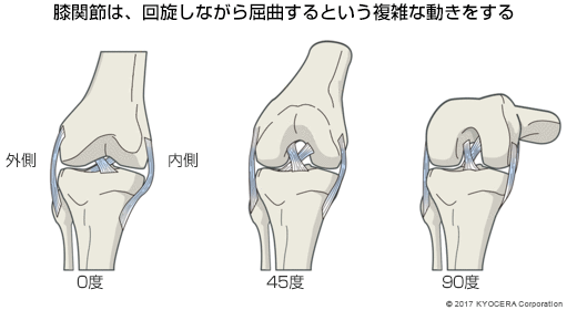 膝関節は、回旋しながら屈曲するという複雑な動きをする