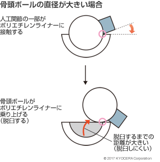 骨頭ボールの直径が大きい場合