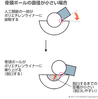 骨頭ボールの直径が小さい場合