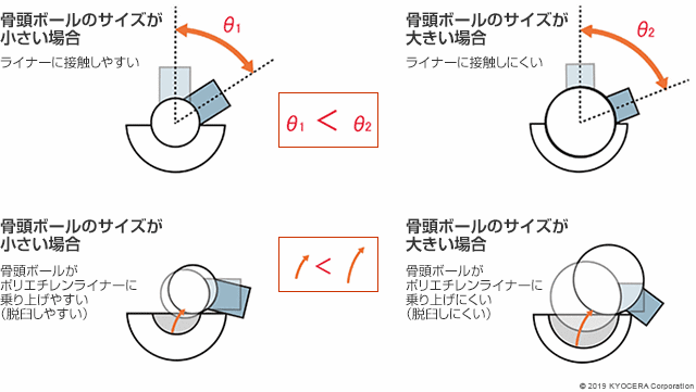 骨頭ボールのサイズが小さい場合 骨頭ボールのサイズが大きい場合