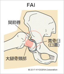 FAI