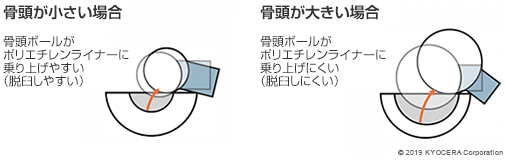 骨頭が小さい場合 骨頭が大きい場合