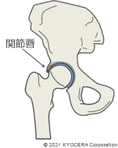 関節唇