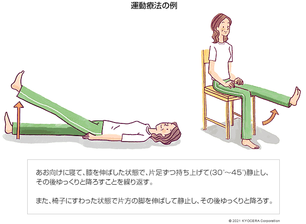 運動療法の例