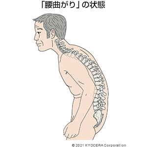 「腰曲がり」の状態