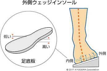 外側ウェッジインソール