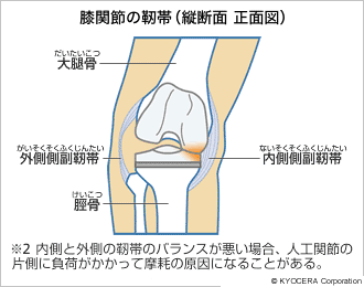膝関節の靭帯（縦断面 正面図）