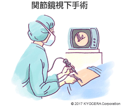 関節鏡視下手術
