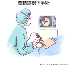 関節鏡視下手術