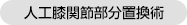 人工膝関節部分置換術