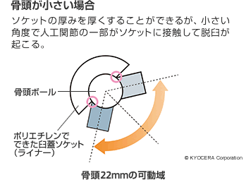 骨頭が小さい場合