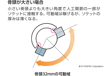 骨頭が大きい場合