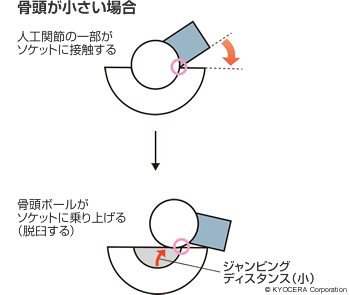 骨頭が小さい場合