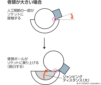 骨頭が大きい場合