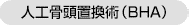 人工骨頭置換術（BHA）