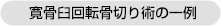 寛骨臼回転骨切り術の一例