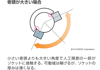 骨頭が大きい場合