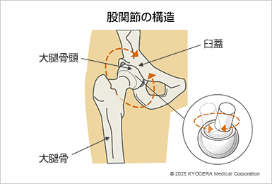 股関節の構造の図