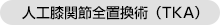 人工膝関節全置換術（TKA）