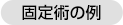 固定術の例