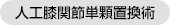 人工膝関節単顆置換術