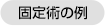 固定術の例