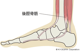 後脛骨筋