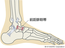 前距腓靭帯