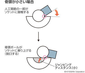 骨頭が小さい場合