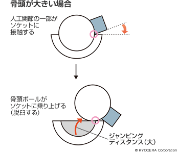 骨頭が大きい場合