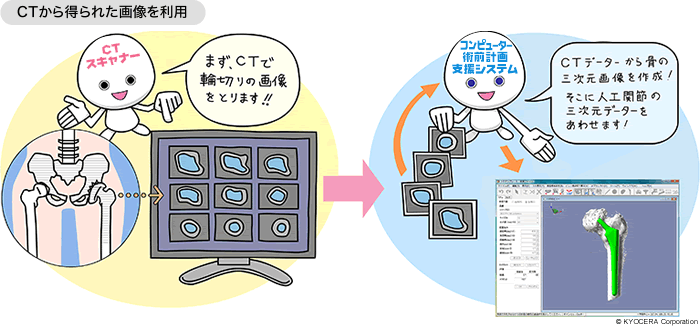 CTから得られた画像を利用