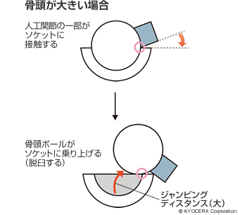 骨頭が大きい場合