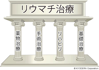 リウマチ治療 イメージ