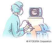 関節鏡視下手術