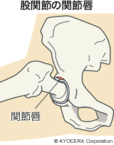 股関節の関節唇