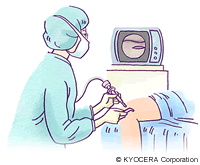 関節鏡下手術 イラスト