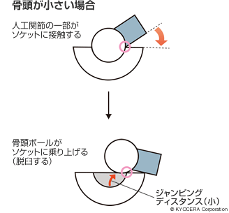 骨頭が小さい場合