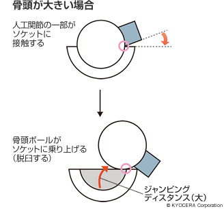 骨頭が大きい場合