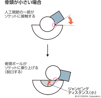 骨頭が小さい場合