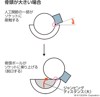 骨頭が大きい場合