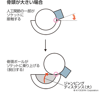 骨頭が大きい場合