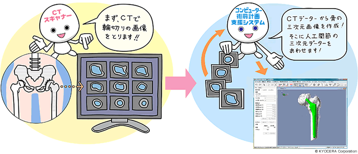 CTから得られた画像を利用