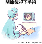 関節鏡視下手術