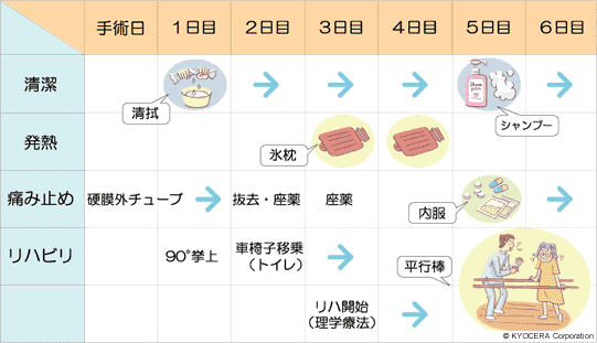 手術～退院までのスケジュール