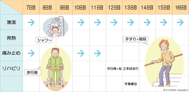 リハビリのスケジュール