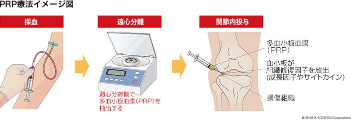 PRP療法イメージ図