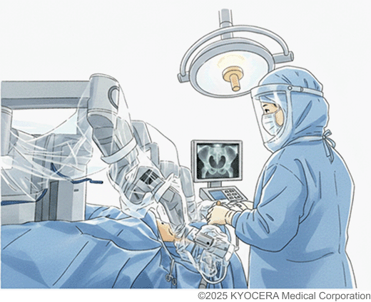手術支援ロボット